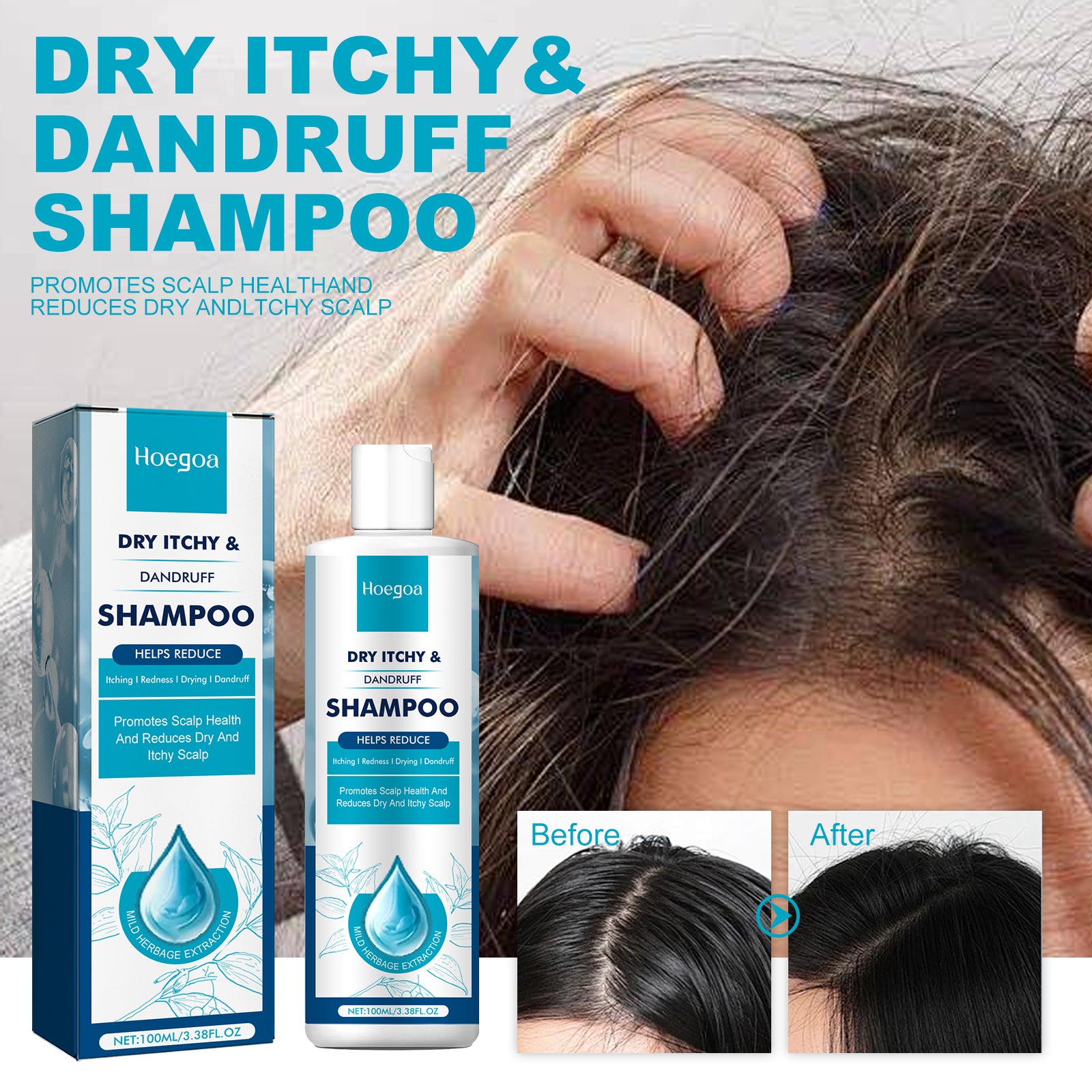Hoegoa Dryitchy & Dandruff Shampoo, Hair Deep Cleansing Refreshing Anti-Dandruff Anti-Itching Solid Hair Dense Hair Supple Shampoo
