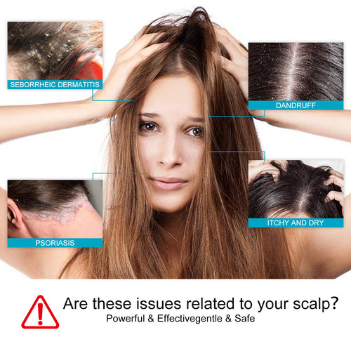 Hoegoa Dryitchy & Dandruff Shampoo, Hair Deep Cleansing Refreshing Anti-Dandruff Anti-Itching Solid Hair Dense Hair Supple Shampoo