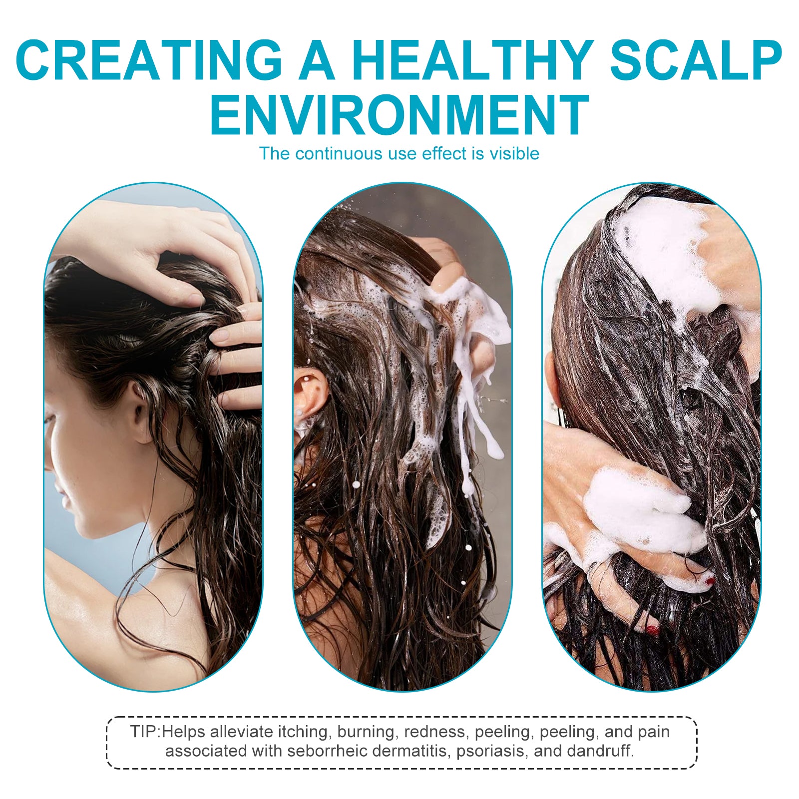 Hoegoa Dryitchy & Dandruff Shampoo, Hair Deep Cleansing Refreshing Anti-Dandruff Anti-Itching Solid Hair Dense Hair Supple Shampoo